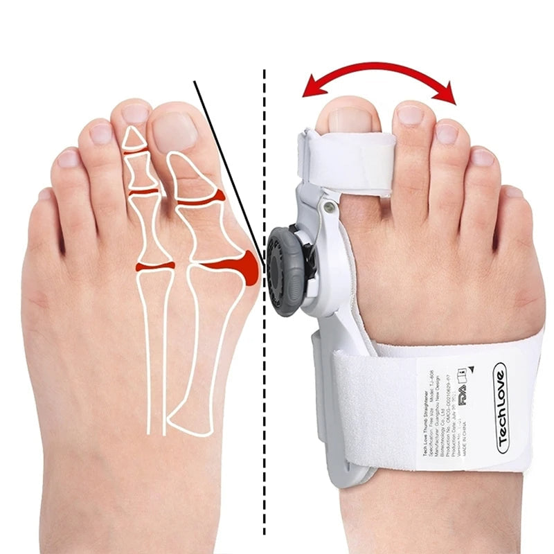 Orthèse de correction Hallux Valgus